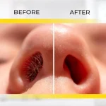 Nose Trimmer - Image 3